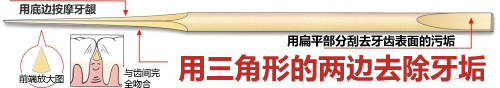 齿间牙签 “三角形齿间牙签”