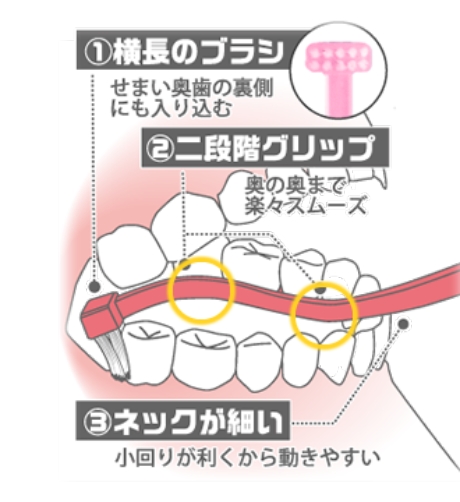 奥歯の裏側まで届く　３つのポイント！